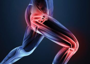 Joint Replacement (Arthoplasties)